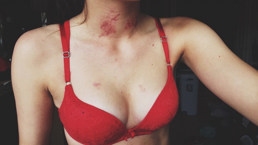 Tumblr